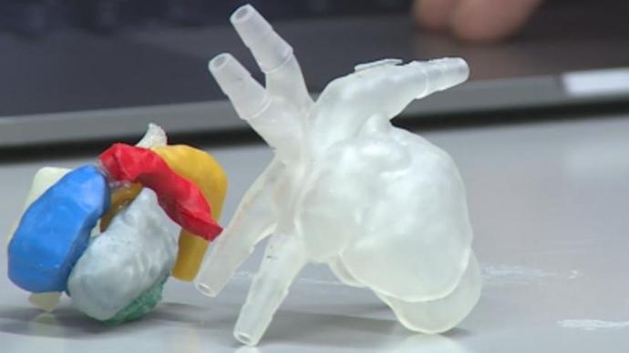 UW Hospital surgeons use 3D printing to prepare for heart surgeries ...